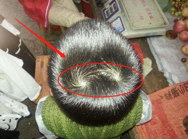 为什么有的孩子头上有2个旋代表啥意思家长都应了解下